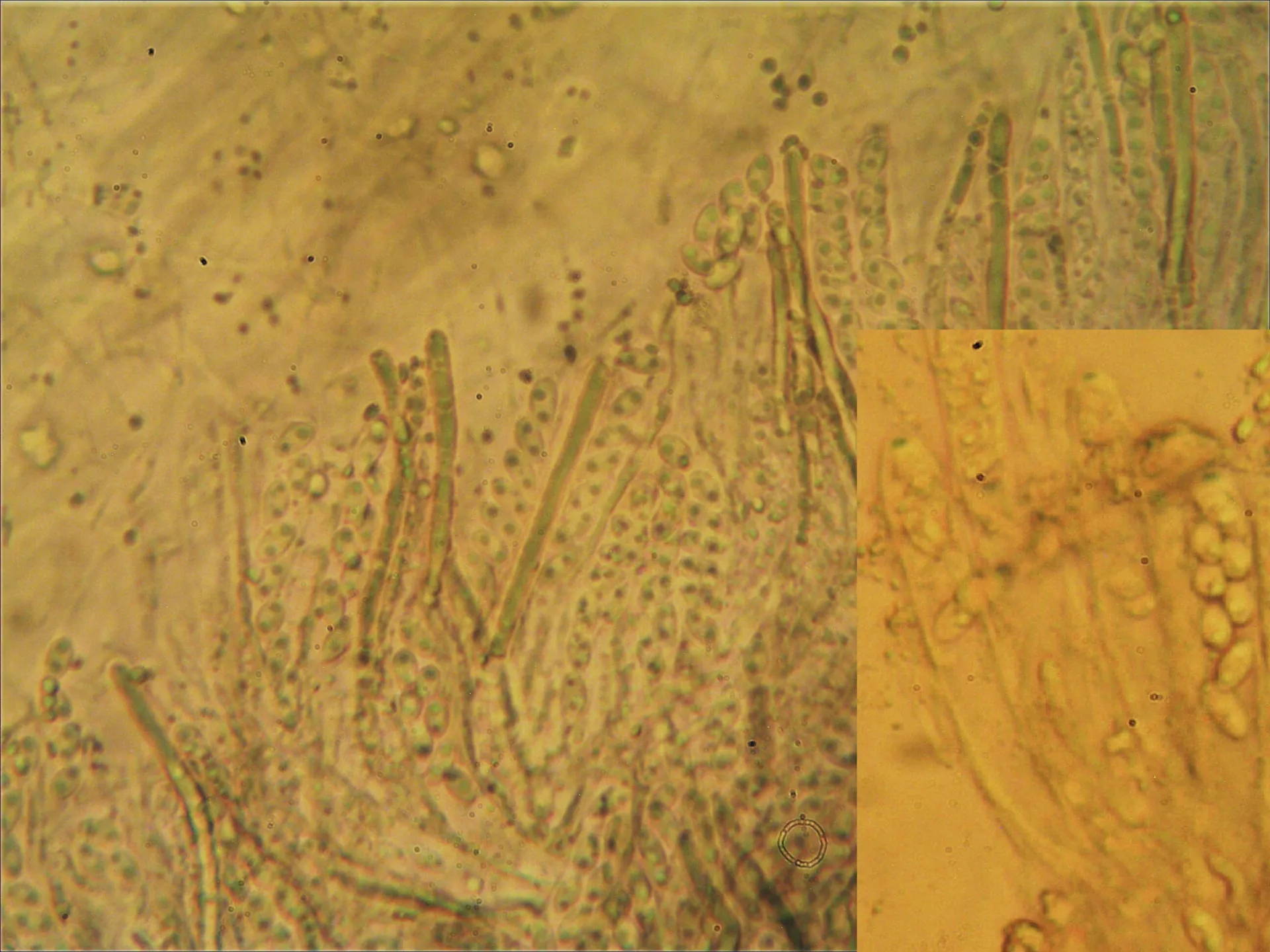 Microscopía de Ombrophila janthina - Himenio + ascos IKI+